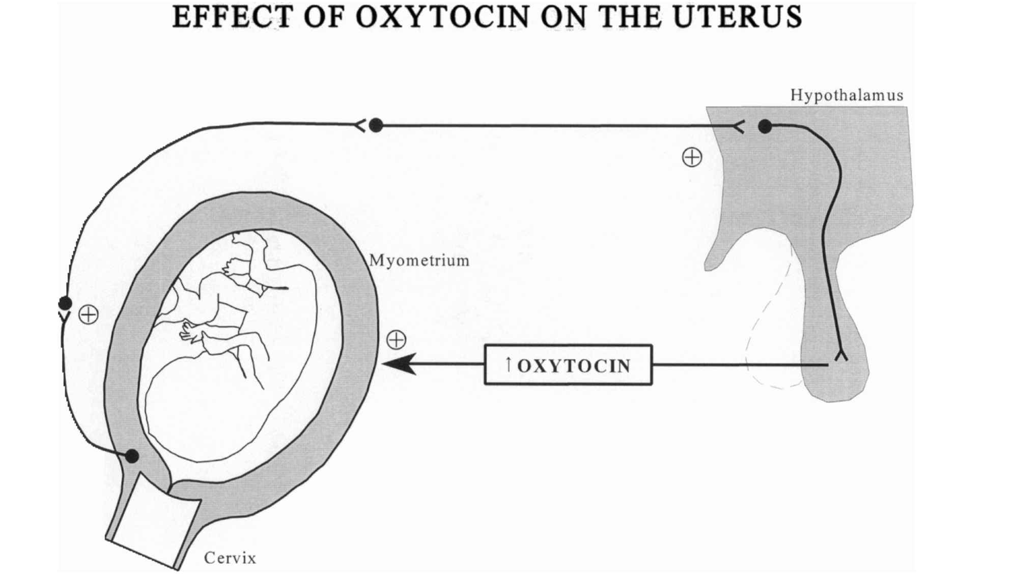 <p><span style="color: rgb(53, 244, 2);"><strong>Oxytocin affects the myometrium</strong></span>, as it increases both the frequency and the</p><p>duration of action potentials during uterine contractions.</p><ul><li><p>Thus, administration of oxytocin initiates contractions in a quiescent uterus and increases the strength and frequency of muscle contractions in an active uterus.<br>Positive Feedback</p></li></ul><p></p>