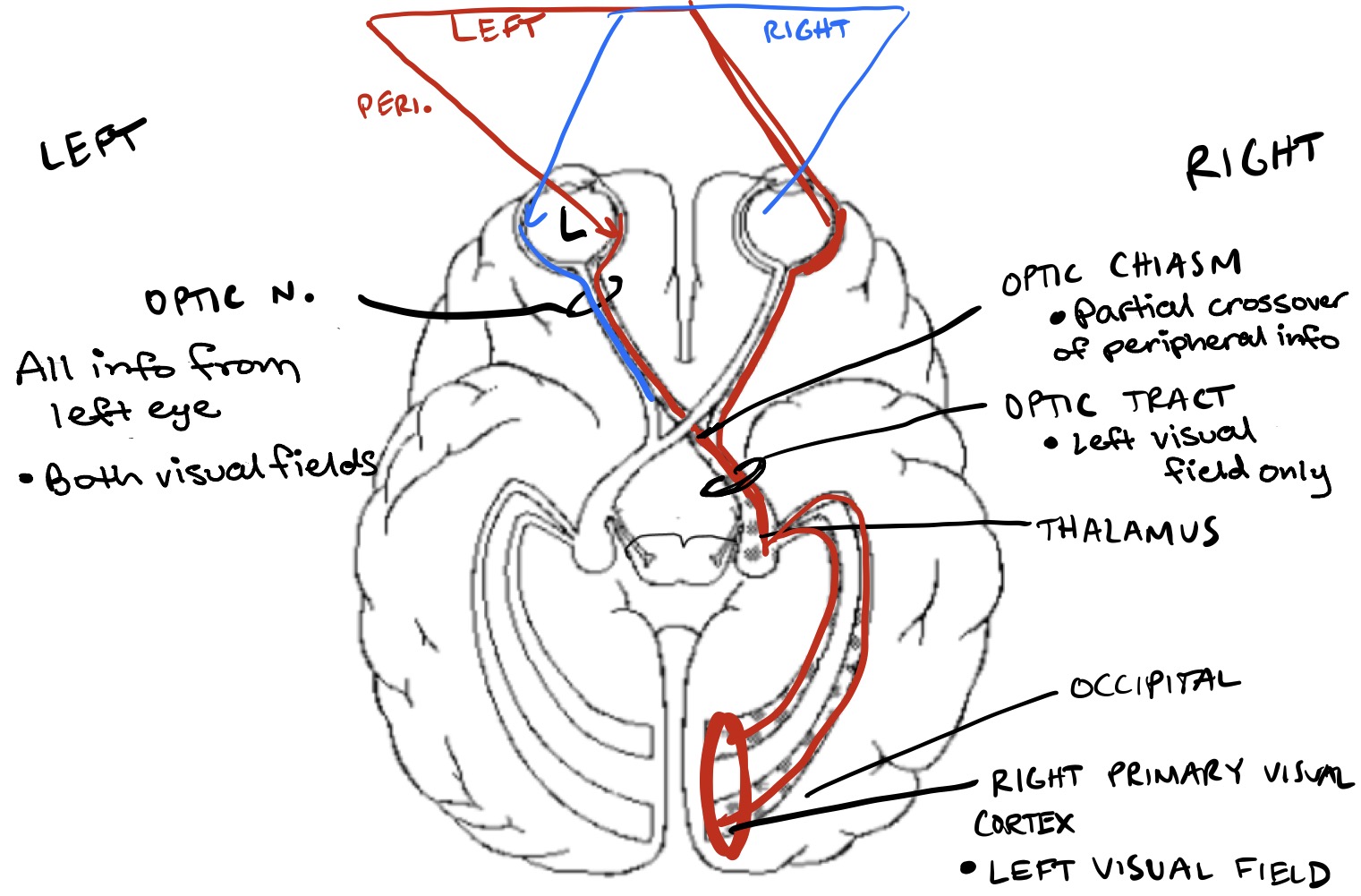 <ul><li><p><strong>Optic nerve coming from left eye:</strong> <span style="color: rgb(140, 26, 244);">all info from left eye (both visual fields)</span></p></li><li><p><strong>Optic chiasm</strong>: partial crossover of peripheral info</p></li><li><p><strong>Optic tract on right side</strong>:<span style="color: rgb(249, 31, 31);"> left visual field only </span></p></li><li><p><strong>Right primary visual field:</strong> <span style="color: rgb(247, 19, 19);">left visual field </span></p></li></ul><p></p>