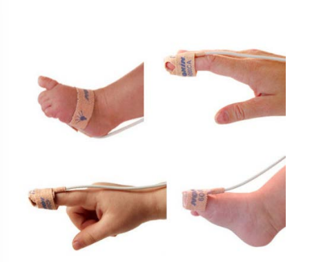 <p>pulse oximetry is a painless, simple, timely, noninvasive test performed on all infants </p>
