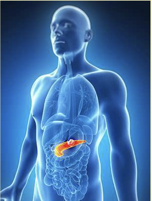 <p>Pancreatic (a)</p>