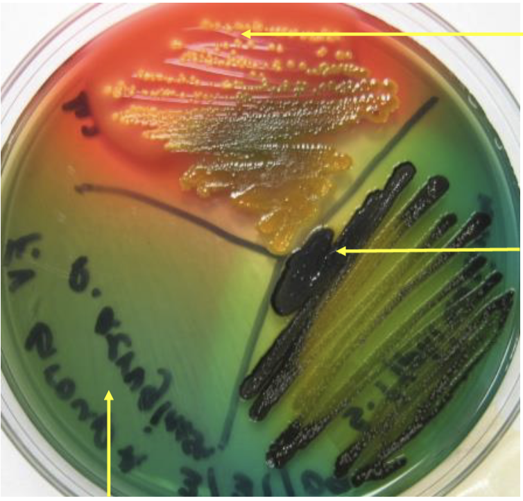 <p>name a bacteria that has black production?</p>