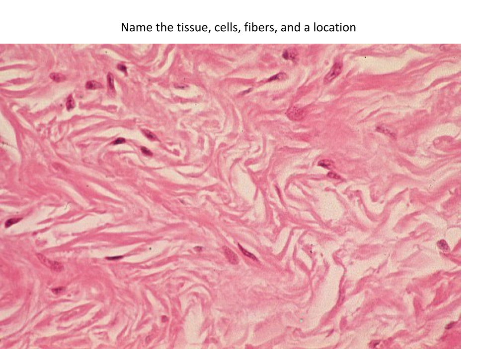 <p>Location of this tissue?</p>