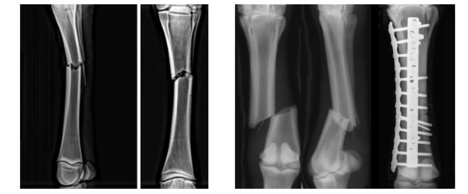 <p>What type of fracture is this</p>