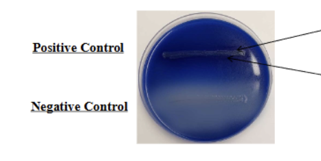 <ul><li><p>Positive = Dark precipitate around inoculation (due to LOWERING of PH)</p><ul><li><p>Lipid depletion around inoculation aka ZONE of hydrolysis</p></li></ul></li></ul><ul><li><p>Negative = NO dark precipitate</p></li></ul><p></p>