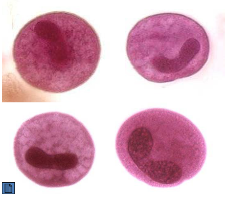 <p>Symptoms and Keywords of Balantidium coli</p>