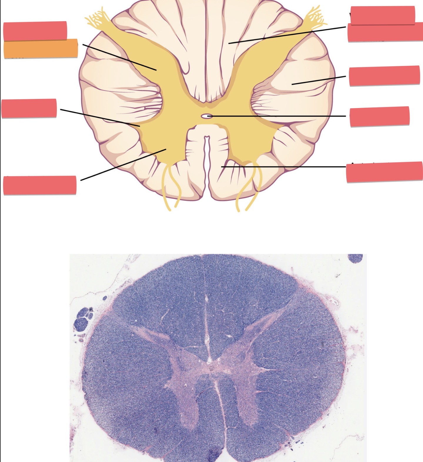 term image