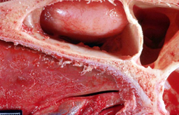 <p>causa e consequencia</p>