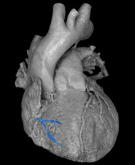<p>identify the structure</p>