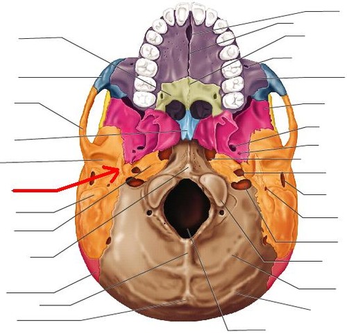 term image