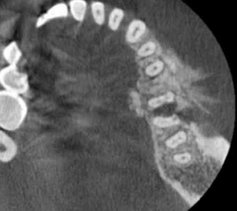 <p>most likely diagnosis?</p>