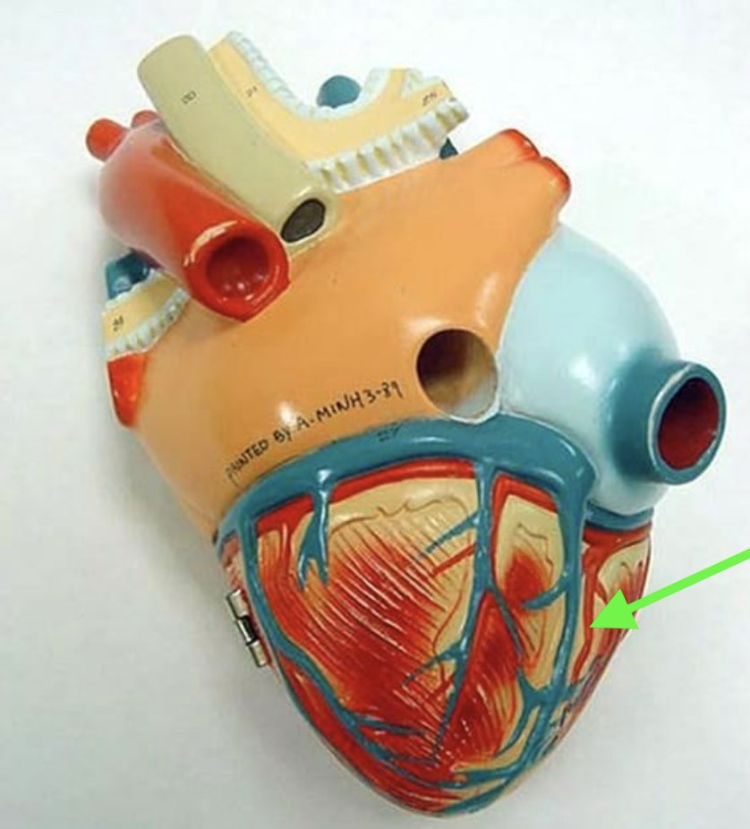 <p><span><strong>Identify the indicated vessel.</strong></span></p>