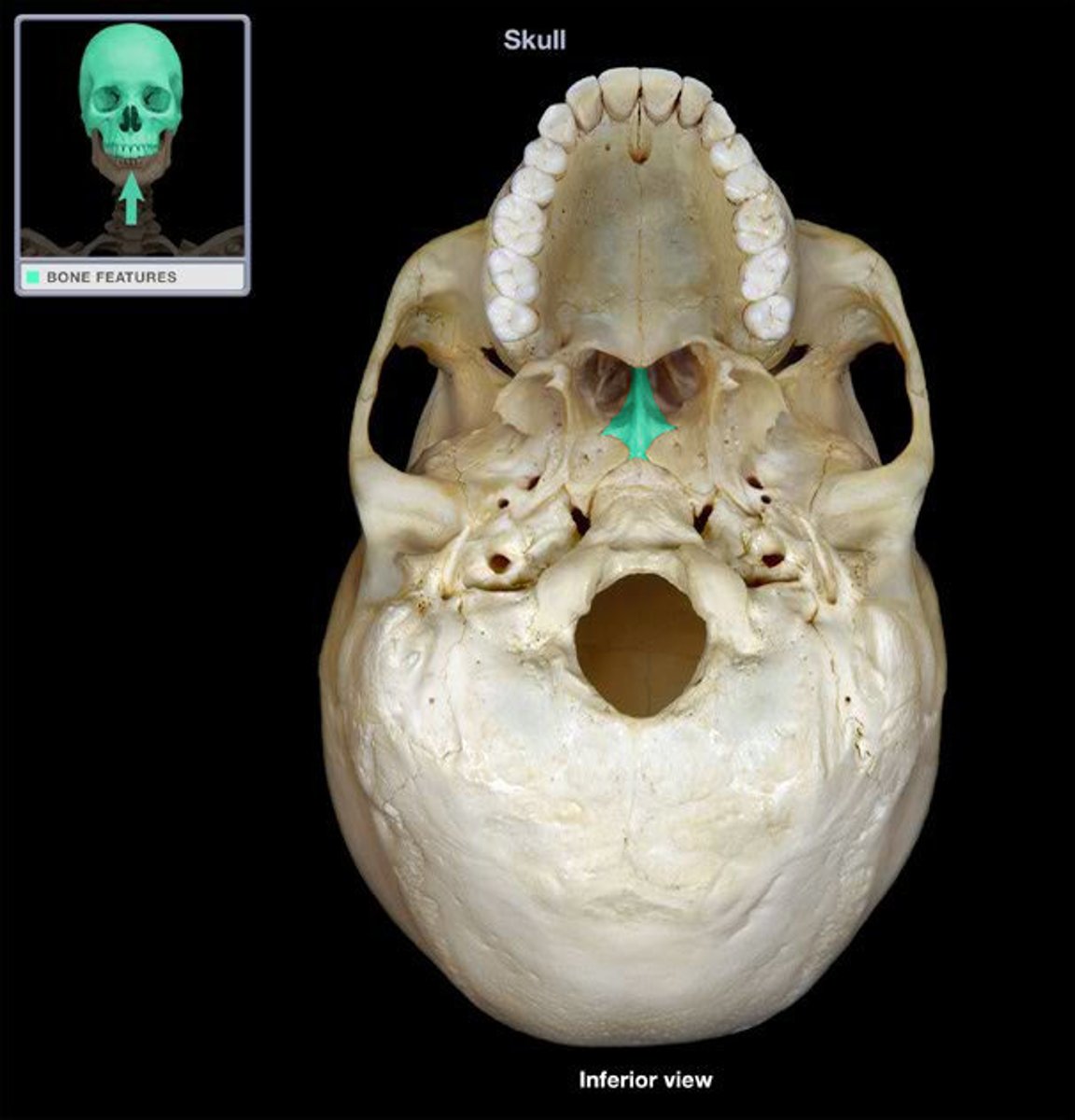 <p>What bone is this?</p>