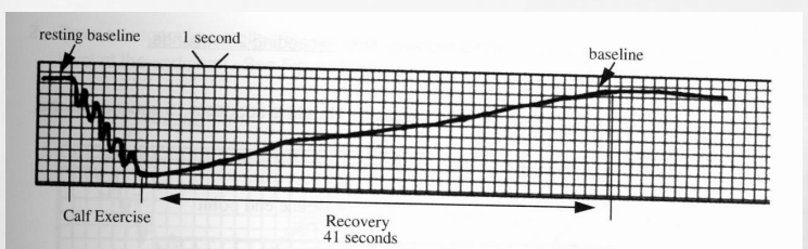 <p>what does this tracing above represents?</p>