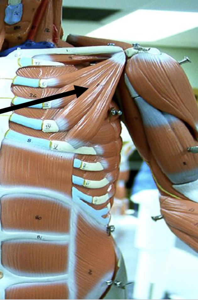 <p>Pectoralis minor</p>