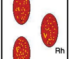 <p>What is the blood type indicated by the results in the right tray?</p>