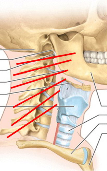 <ul><li><p>facet orientation → BUM (facets open w/ flex)</p><ul><li><p>upper facets (C2-C3) → angled near transverse plane</p></li><li><p>lower facets (C4-C7) → angle tangential to transverse + coronal plane</p></li></ul></li><li><p>facets/articular pillars open w/ flexion (forward bending)</p><ul><li><p>w/ SB + rotation → contralateral side open</p></li></ul></li></ul><p></p>