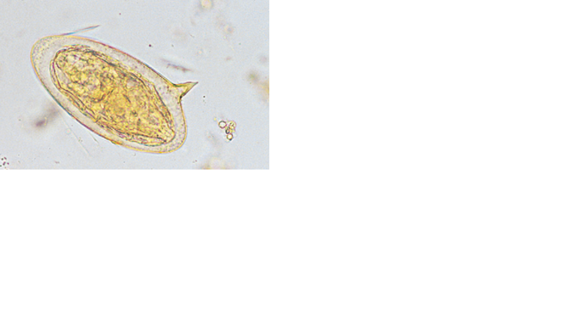 <p>Name the fluke or flatworm</p>