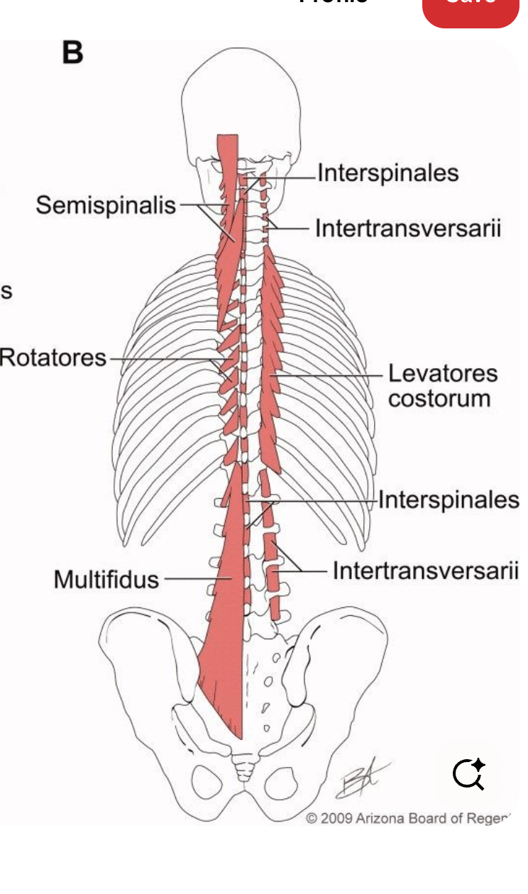 <p>Name the regions of the transversospinalis</p>