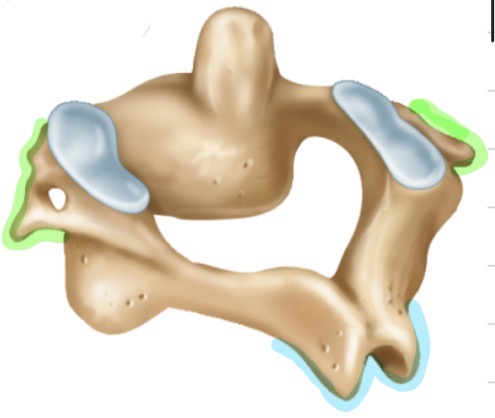 <p>What is the name of this vertebrae?</p>