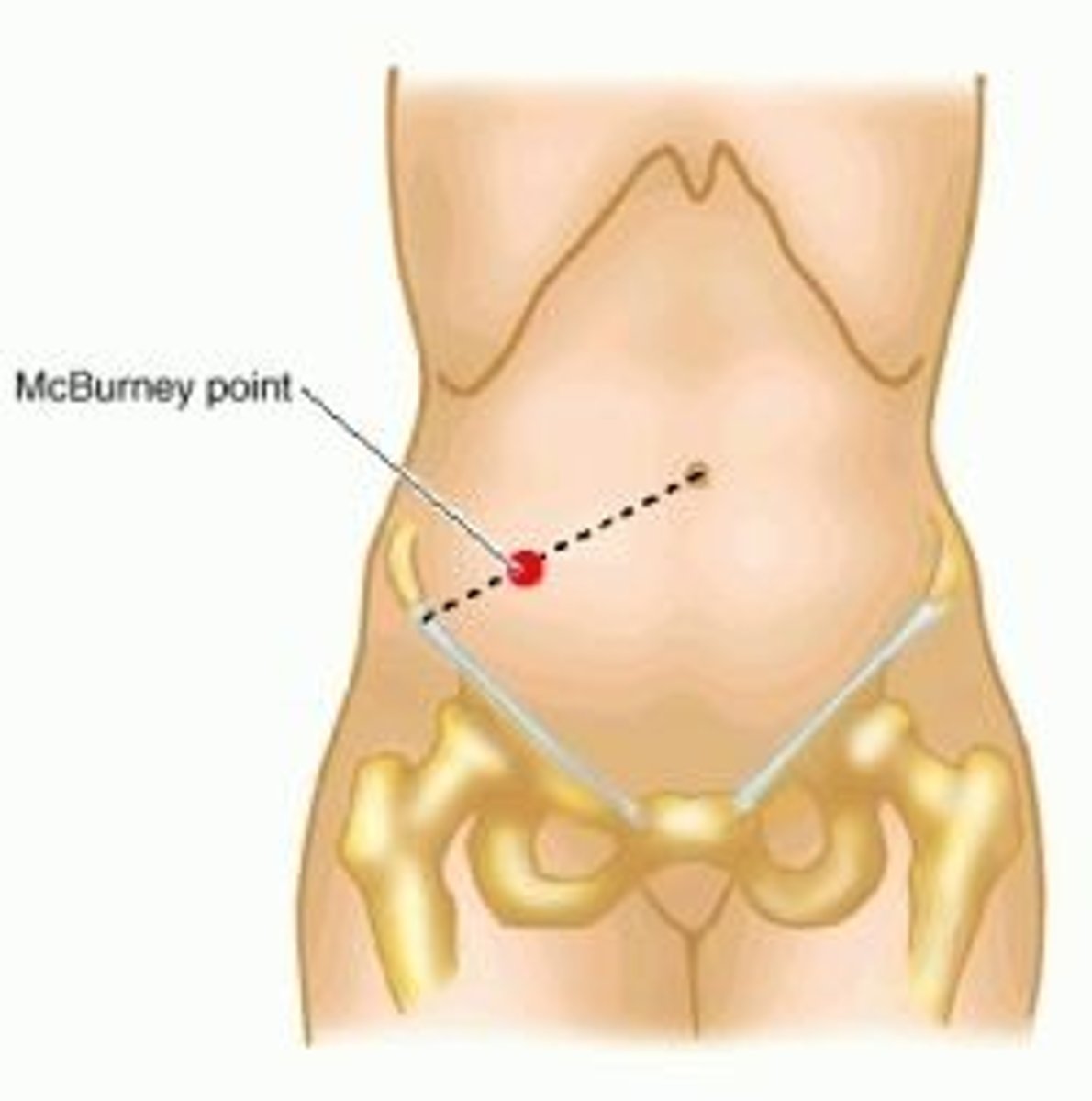 <p>press and painful</p>