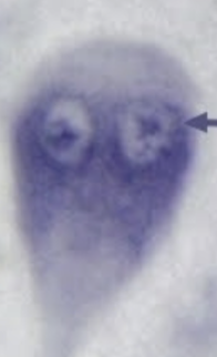 <p>What protist is this?</p>