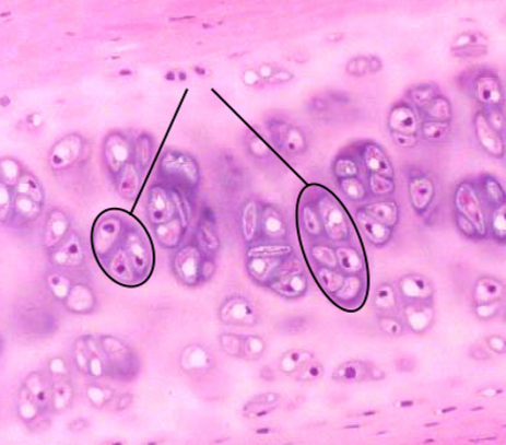 <p>Chondrocytes Isogenous Groups</p>