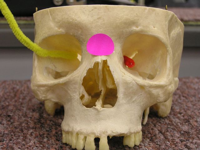 <p><span>Identify the opening labeled with the yellow pick cleaner.</span></p>