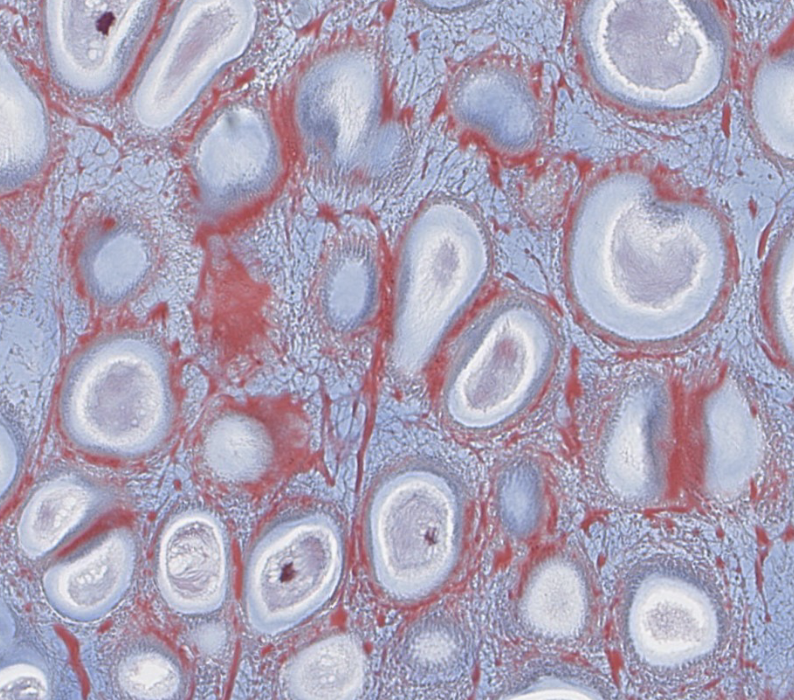 <p>elastic cartilage</p>
