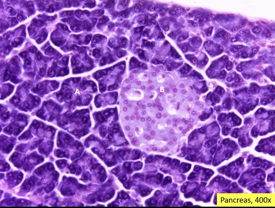 <p><span><span>Identify structure B.</span></span></p><p><span><span>Are the cells at B endocrine or exocrine?</span></span></p>