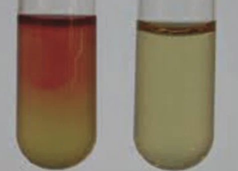 <p>The image <span>shows the results of the&nbsp;<strong>Voges-Proskauer IMViC test.</strong>&nbsp;Interpret</span> the result. </p>