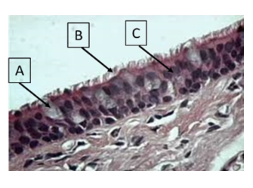 <p>name structure b</p>