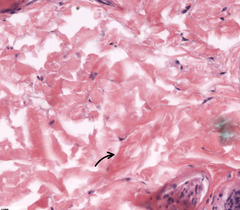 <p>The majority of this connective tissue is staining eosinophilically due to...?</p>