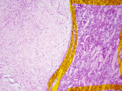 <p>what is the highlighted part</p>