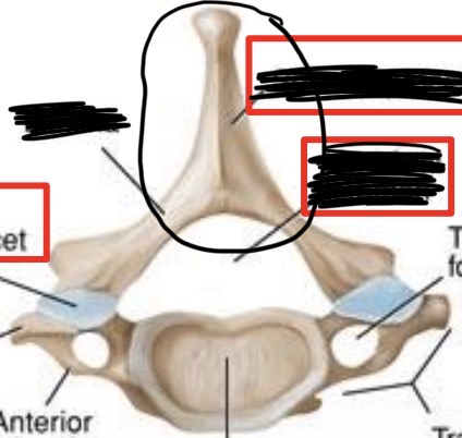 <p>What is this part of the vertebrae?</p>
