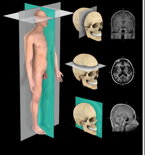 <p>Median plane (midsagittal plane)</p>