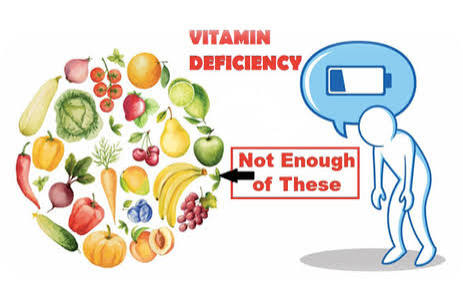<p>Deficient </p>