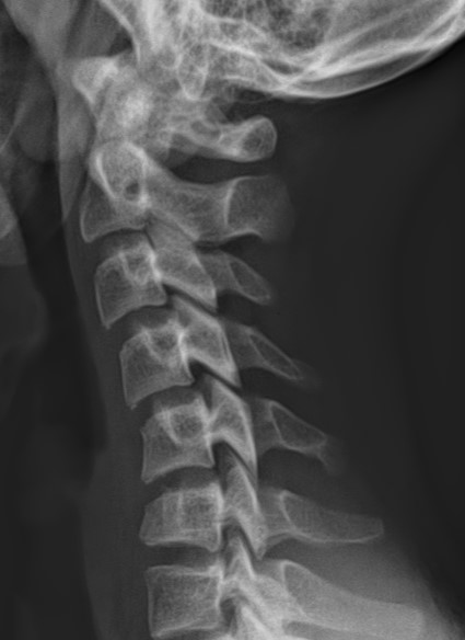 <p>What is the diagnosis?</p>