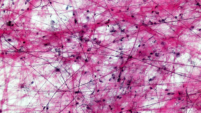 <p>what type of tissue is this? </p>