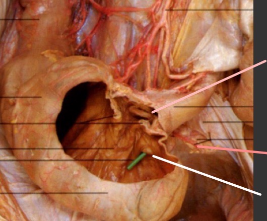 term image