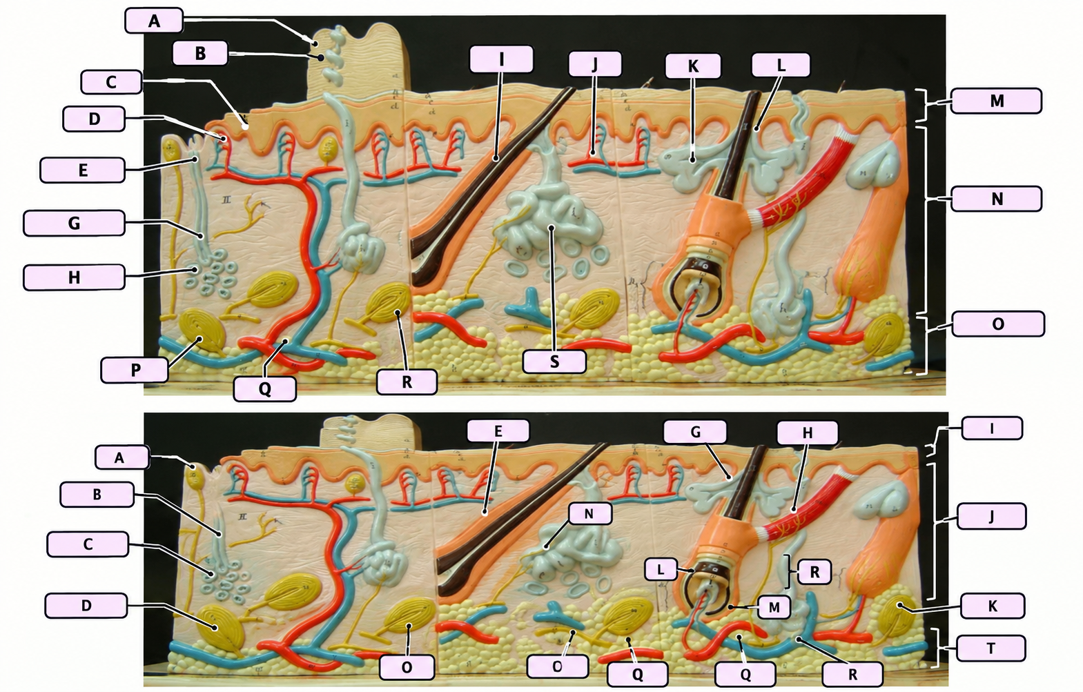 <p>(A. -bottom image) </p><p>A sensory receptor located in the upper dermis that detects light touch.</p>