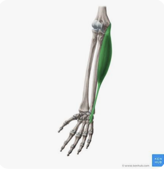 <p>O: Medial epicondyle + olecranon of ulna</p><p>I: Base of 5th metacarpal; hook of the hamate; pisiform bone</p><p>A: Flexion of hand; adduction/ulnar deviation of hand</p><p>N: Ulnar nerve</p>