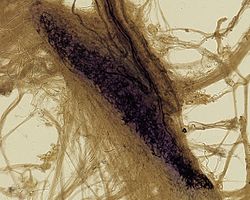 <p>Ruffini Corpuscle</p>