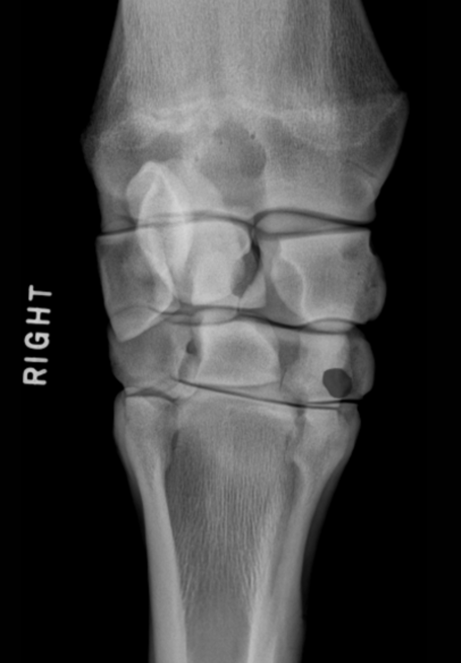 <p>(Eq.) Carpus: Hvilken knogle er dette (D-Pa)</p>