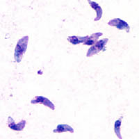 <p>toxoplasma gondii</p>