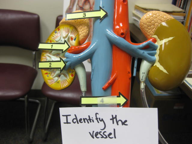 <p>Identify The Vessel 1, 2, 3 and 4?</p><p>Lab Image 3-12</p>