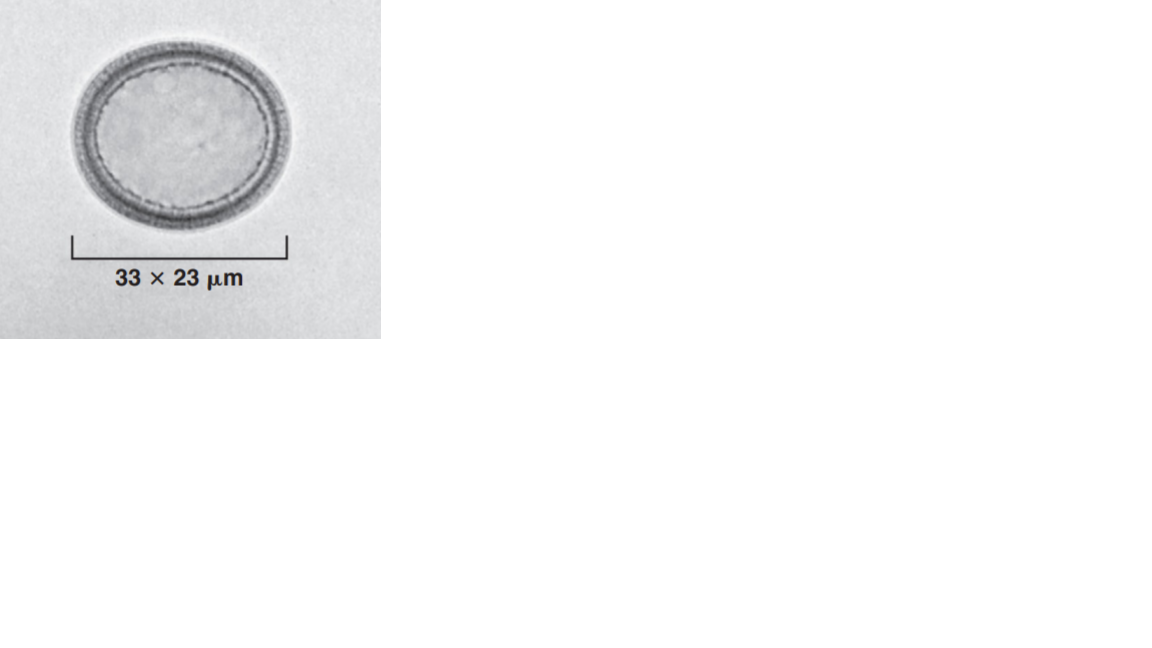 <p>Name the fluke or flatworm</p>