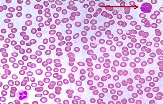 <p>Tế bào gì ?</p>