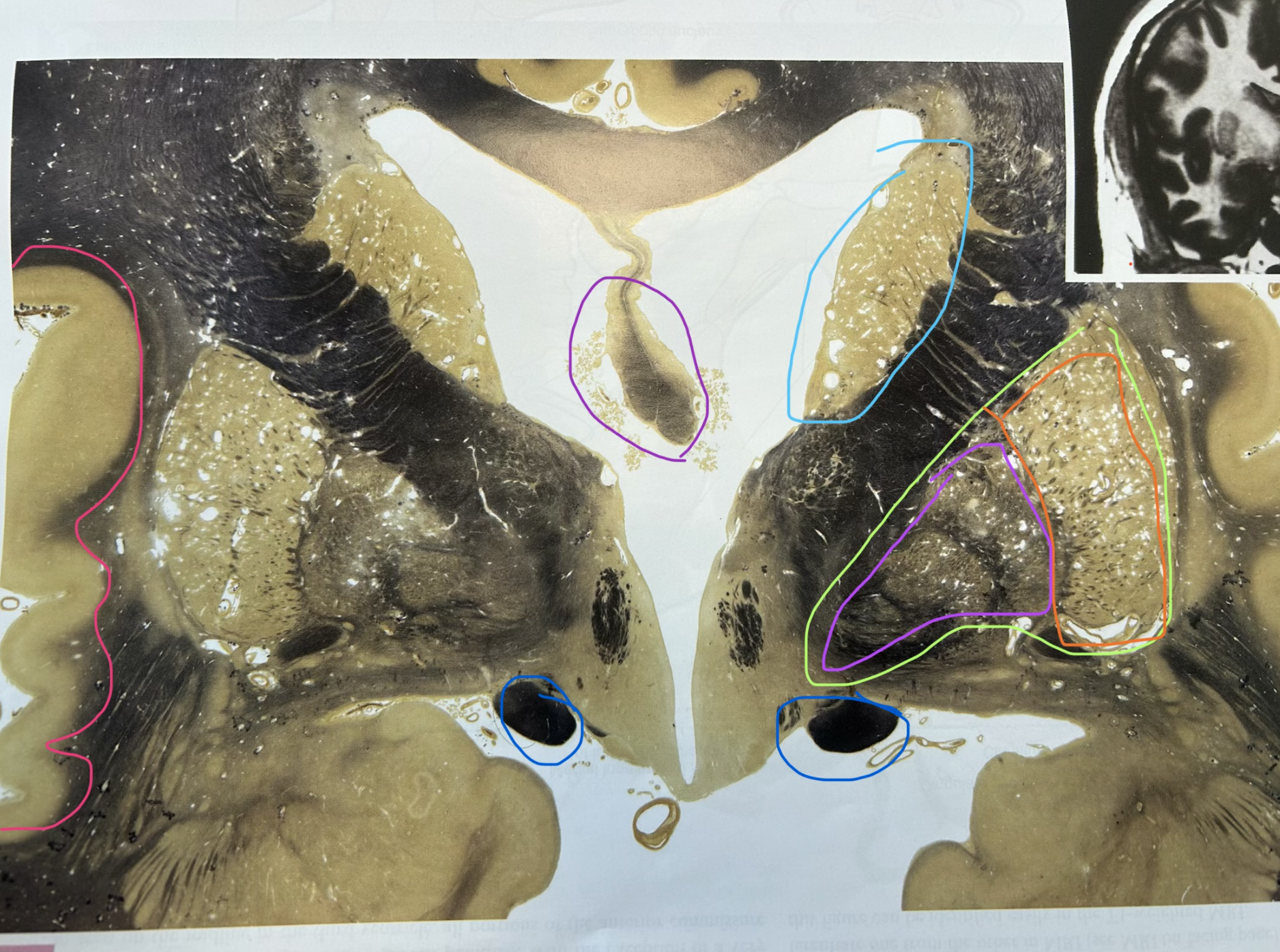 <p>what is purple</p>