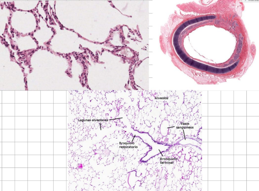 <p>El pulmón tiene parte de conducción y parte respiratorias, señale la parte que todavía tiene musculo liso:</p>