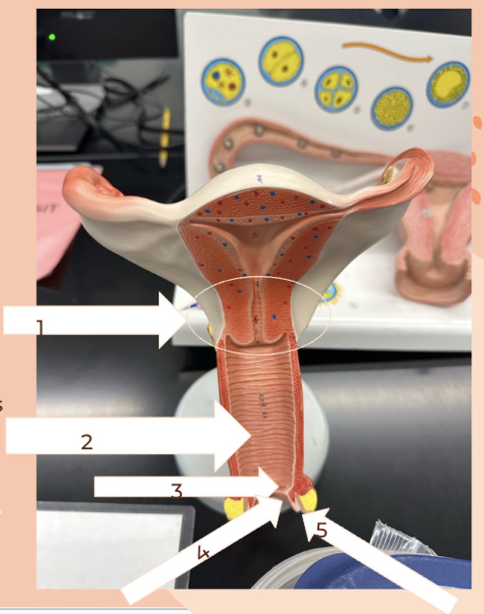<p>#1</p><p>• semi-cartilaginous ring of tissue separating the body of the uterus from the vagina</p>